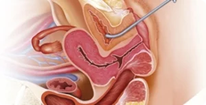 Pagina Principal1 17 Ilustração do sistema reprodutor masculino.