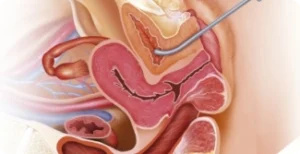 Pagina Principal1 21 Ilustração do sistema reprodutivo feminino