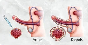 Pagina Principal1 22 Procedimento médico antes e depois