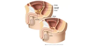 Pagina Principal1 5 VASECTOMIA
