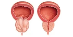 Pagina Principal1 6 Ilustração do sistema reprodutor masculino
