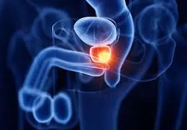 Urologista em Sorriso MT - Consultas, Tratamentos e Cirurgias Urológicas com Dr. Rodolfo Garcia Borges 7 Urologista especialista em próstata em Sorriso